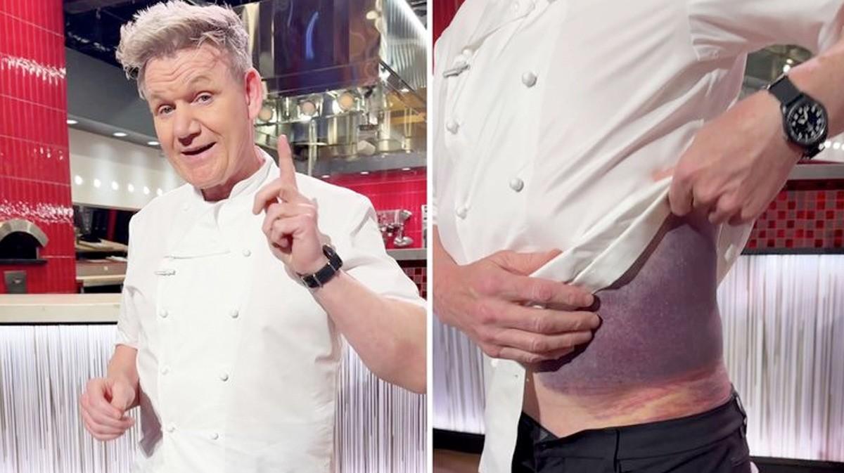 Gordon Ramsay cade in bici: "Indossate il casco, mi ha salvato la vita". Brutta caduta in bicicletta per il celebre Chef - Bike Advice